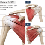 회전근 개 파열 증상 치료를 위한 재활법