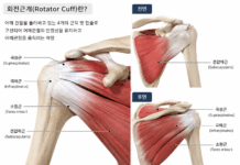 회전근 개 파열 증상 치료를 위한 재활법