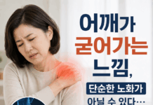 어깨가 굳어가는 느낌, 단순한 노화가 아닐 수 있다… 오십견 초기 관리가 중요한 이유