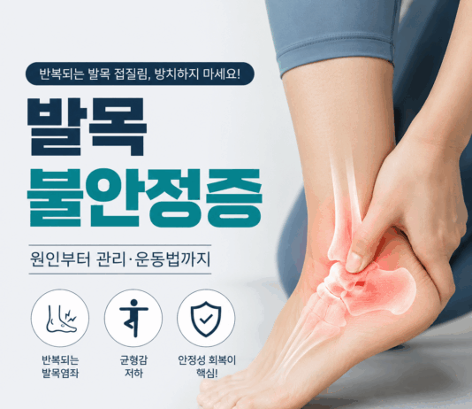 발목 불안정증, 반복되는 발목 접질림을 방치하면 안 되는 이유